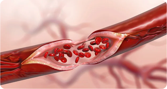 why personalized picture